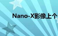 Nano-X影像上个月股价上涨了17%