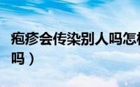 疱疹会传染别人吗怎样避免（疱疹会传染别人吗）