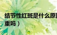 结节性红斑是什么原因造成的（结节性红斑严重吗）