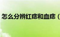 怎么分辨红痣和血痣（怎样辨别红痣和血痣）