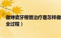 做烤瓷牙根管治疗是怎样做的?（亲历根管治疗及做烤瓷牙全过程）