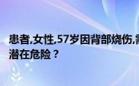 患者,女性,57岁因背部烧伤,需要俯卧位,哪个部位没有压疮的潜在危险？