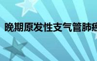 晚期原发性支气管肺癌患者最突出的症状是: