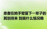 患者在她手臂留下一辈子的“牙印”！她却说“这笔账”极其划得来 到底什么情况嘞