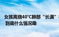 女孩高烧40℃肺部“长满”霉斑！多人中招这个细节要警惕 到底什么情况嘞