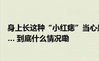 身上长这种“小红痣”当心是肝癌！洗澡时可得多留个心眼… 到底什么情况嘞