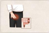 大同肛泰肛肠医院详解一旦出现这几种症状，提醒我们该做肠镜了