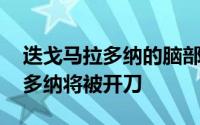 迭戈马拉多纳的脑部血肿将被开刀 迭戈马拉多纳将被开刀