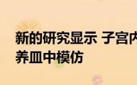 新的研究显示 子宫内膜疾病可以在实验室培养皿中模仿